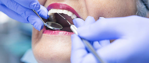 Best Emergency Dental Extractions in Pantops, VA